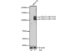 Western blot analysis of extracts of NIH/3T3 cells, using Phospho-CD117/c-Kit-Y719 antibody (ABIN7268408) at 1:500 dilution. (KIT antibody  (pTyr719))