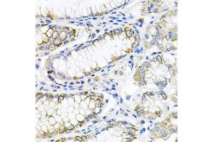 Immunohistochemistry of paraffin-embedded human stomach using ACVR2A antibody (ABIN5971030) at dilution of 1/100 (40x lens). (ACVR2A antibody)