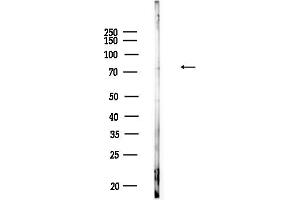Western blot analysis of lysates from Raji cells(heat-shock,45 min treatment), using Phospho-SHP2 (Tyr542)[Tyr546] Antibody at 1/1000 dilution.