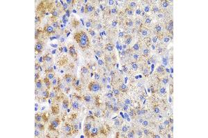 Immunohistochemistry (IHC) image for anti-Cbl Proto-Oncogene B, E3 Ubiquitin Protein Ligase (CBLB) (AA 1-350) antibody (ABIN3015830) (Cbl Proto-Oncogene B, E3 Ubiquitin Protein Ligase (CBLB) (AA 1-350) antibody)