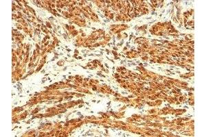 Formalin-fixed, paraffin-embedded human uterus stained with Calponin antibody (CNN1/832 + CALP). (Calponin antibody)
