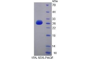 Image no. 1 for Activating Transcription Factor 7 (AFT7) (AA 234-436) protein (His tag) (ABIN6238139)