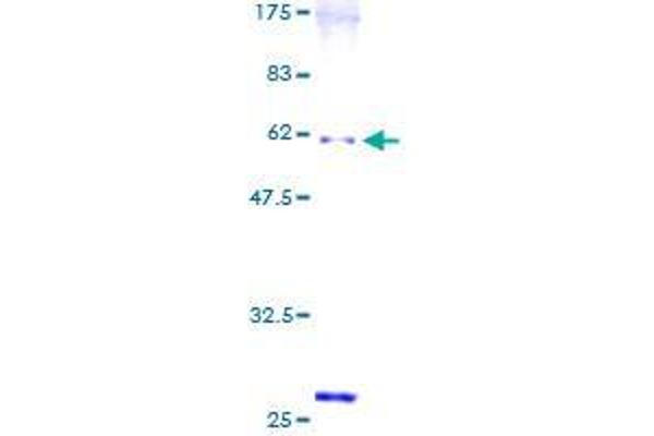 SNX6 Protein (AA 1-290) (GST tag)