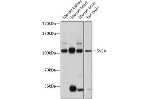 Western blot analysis of extracts of various cell lines, using SV2A antibody (ABIN7270665) at 1:1000 dilution. (SV2A antibody  (AA 356-447))