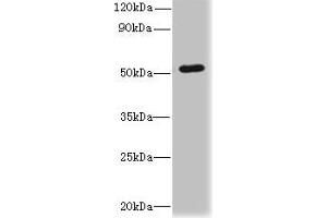 Western blot All lanes: SNX6 antibody at 4 μg/mL + Hela whole cell lysate Secondary Goat polyclonal to rabbit IgG at 1/10000 dilution Predicted band size: 47, 34 kDa Observed band size: 47 kDa