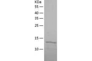 Western Blotting (WB) image for Peptidyl-tRNA Hydrolase Domain Containing 1 (PTRHD1) (AA 1-140) protein (His tag) (ABIN7287613) (PTRHD1 Protein (AA 1-140) (His tag))