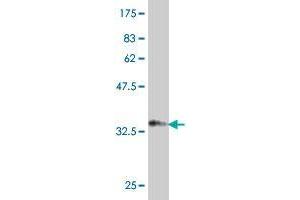 Western Blot detection against Immunogen (37 KDa) . (SORCS2 antibody  (AA 802-900))