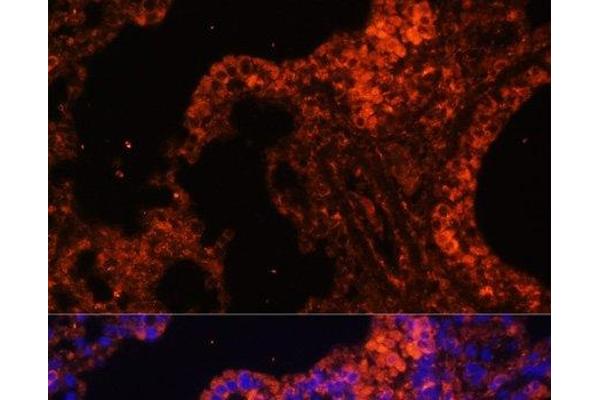 SPTA1 antibody