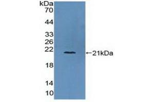 Detection of Recombinant COL6a3, Human using Polyclonal Antibody to Collagen Type VI Alpha 3 (COL6a3) (COL6a3 antibody  (AA 463-624))