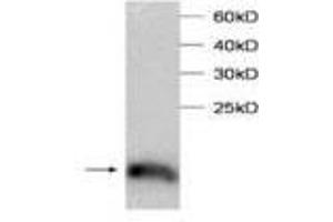 Image no. 1 for anti-Transcription Elongation Factor B (SIII), Polypeptide 2 (18kDa, Elongin B) (TCEB2) antibody (ABIN791478) (TCEB2 antibody)