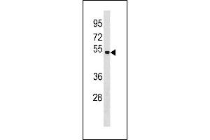 SG6 Antibody (C-term) (ABIN1881822 and ABIN2843309) western blot analysis in MDA-M cell line lysates (35 μg/lane). (SPAG6 antibody  (C-Term))