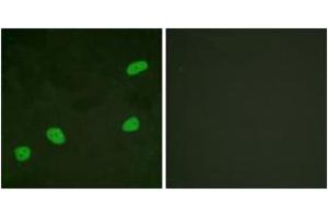 Immunofluorescence analysis of HeLa cells, using ATRIP (Ab-68/72) Antibody. (ATRIP antibody  (AA 34-83))