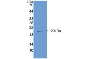 Detection of Recombinant ACE, Human using Polyclonal Antibody to Angiotensin I Converting Enzyme (ACE) (Angiotensin I Converting Enzyme 1 antibody  (AA 1160-1306))