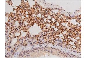 ABIN6269133 at 1/200 staining Mouse lung tissue sections by IHC-P. (KIT antibody  (Internal Region))