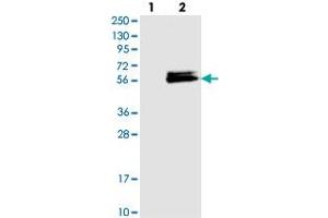 Western blot analysis of Lane 1: Negative control (vector only transfected HEK293T lysate), Lane 2: Over-expression Lysate (Co-expressed with a C-terminal myc-DDK tag (~3. (LACE1 antibody)