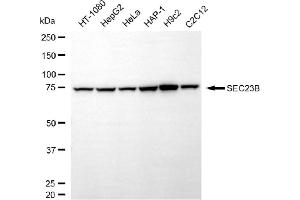 Western blotting analysis using SEC23B antibody (ABIN7800280).
