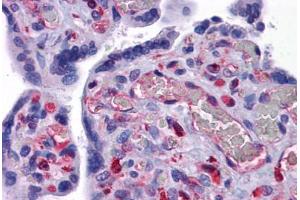 Human Placenta: Formalin-Fixed, Paraffin-Embedded (FFPE) (EFCAB4B antibody  (C-Term))