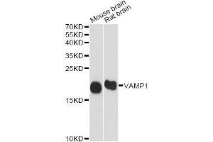 Western blot analysis of extracts of various cell lines, using VAMP1 antibody. (VAMP1 antibody  (AA 1-96))