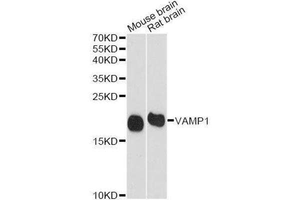 VAMP1 anticorps  (AA 1-96)