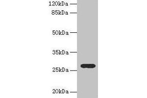 Western blot All lanes: TEX35 antibody at 4 μg/mL + U251 whole cell lysate Secondary Goat polyclonal to rabbit IgG at 1/10000 dilution Predicted band size: 27, 26, 24, 21, 25 kDa Observed band size: 27 kDa (TEX35 antibody  (AA 1-215))