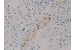 DAB staining on IHC-P; Samples: Human Stomach Tissue (DGKZ antibody  (AA 695-932))