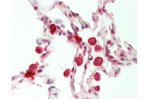 Human Lung: Formalin-Fixed, Paraffin-Embedded (FFPE). (PSMA5 antibody  (AA 143-192))