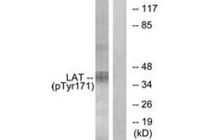 Western blot analysis of extracts from Jurkat cells treated with UV 15', using LAT (Phospho-Tyr171) Antibody. (LAT antibody  (pTyr200))
