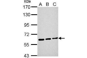 Western Blotting (WB) image for anti-Malic Enzyme 1, NADP(+)-Dependent, Cytosolic (ME1) antibody (ABIN2855777)