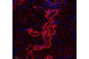 Immunofluorescence of paraffin embedded mouse kidney using CD240d (ABIN7075412) at dilution of 1: 500 (400x lens) (RHD antibody)