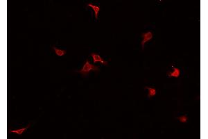 ABIN6269219 staining HUVEC cells by IF/ICC. (Cadherin 5 antibody  (C-Term))