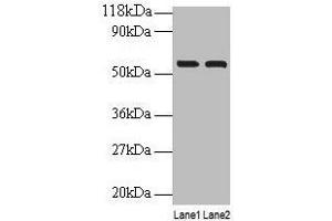 Western blot All lanes: IMPDH2 antibody at 2 μg/mL Lane 1: EC109 whole cell lysate Lane 2: 293T whole cell lysate Secondary Goat polyclonal to rabbit IgG at 1/15000 dilution Predicted band size: 56 kDa Observed band size: 56 kDa (IMPDH2 antibody  (AA 5-514))