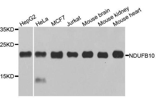 NDUFB10 antibody  (AA 1-172)