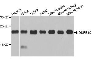 Western blot analysis of extracts of various cell lines, using NDUFB10 antibody. (NDUFB10 antibody  (AA 1-172))
