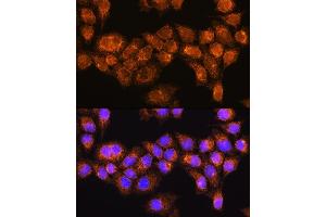 Immunofluorescence analysis of HeLa cells using R Rabbit pAb (ABIN7269787) at dilution of 1:100. (RABL3 antibody  (AA 1-236))