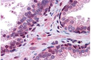 Human Prostate: Formalin-Fixed, Paraffin-Embedded (FFPE) (GID8/C20orf11 antibody  (C-Term))
