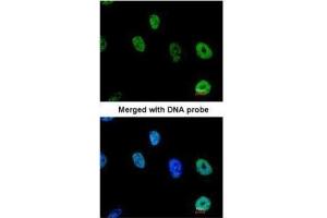 ICC/IF Image Immunofluorescence analysis of paraformaldehyde-fixed HeLa, using TAP , antibody at 1:200 dilution. (NXF1 antibody  (N-Term))
