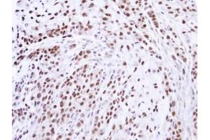 IHC-P Image Immunohistochemical analysis of paraffin-embedded A549 xenograft , using ZNF346, antibody at 1:100 dilution. (ZNF346 antibody)