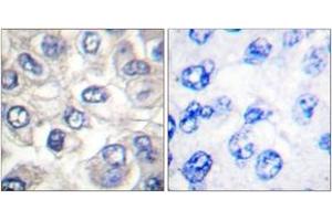 Immunohistochemistry (IHC) image for anti-BCL2-Associated Agonist of Cell Death (BAD) (AA 21-70), (Cleaved-Asp71) antibody (ABIN2891153) (BAD antibody  (Cleaved-Asp71))