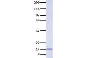 Validation with Western Blot (IL-31 Protein)