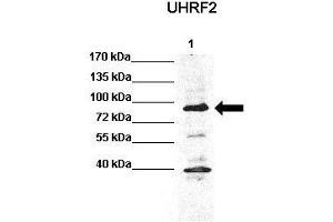 WB Suggested Anti-Uhrf2 Antibody  Positive Control: Lane 1: 60ug HCT116 lysate  Primary Antibody Dilution :  1:1000 Secondary Antibody : Anti rabbit-HRP  Secondry Antibody Dilution :  1:5,000 Submitted by: Chinweike Ukomadu, Brigham and Women's Hospital, Boston (UHRF2 antibody  (N-Term))