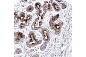 Immunohistochemical staining of human breast with KIAA1586 polyclonal antibody  shows strong cytoplasmic positivity in glandular cells at 1:50-1:200 dilution. (KIAA1586 antibody)