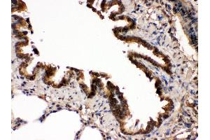 IHC(P): Rat Lung Tissue (MAP2K7 antibody  (N-Term))