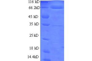 Ornithine Decarboxylase 1 (ODC1) (AA 1-461), (full length) protein (GST tag) (ODC1 Protein (AA 1-461, full length) (GST tag))