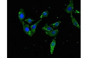 Immunofluorescent analysis of Hela cells using ABIN7172536 at dilution of 1:100 and Alexa Fluor 488-congugated AffiniPure Goat Anti-Rabbit IgG(H+L) (TFEB antibody  (AA 1-476))