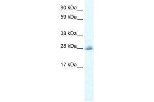 Western Blotting (WB) image for anti-Chloride Channel 5 (CLCN5) antibody (ABIN2461121)