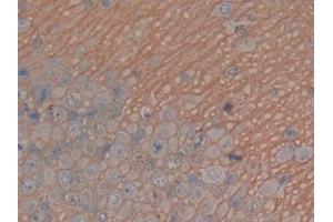 Detection of MAPT in Rat Cerebrum Tissue using Polyclonal Antibody to Tau Protein (MAPT) (tau antibody  (AA 34-368))