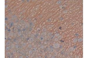 Detection of MAPT in Rat Cerebrum Tissue using Polyclonal Antibody to Tau Protein (MAPT) (tau antibody  (AA 34-368))