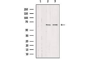 Western blot analysis of extracts from various samples, using SLC9A9 Antibody. (SLC9A9 antibody  (Internal Region))