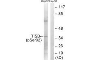 Western blot analysis of extracts from HepG2 cells, using TISB (Phospho-Ser92) Antibody. (ZFP36L1 antibody  (pSer92))