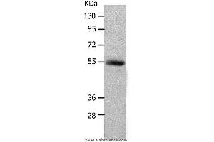 Western blot analysis of Human colon cancer tissue, using MMP17 Polyclonal Antibody at dilution of 1:550 (MMP17 antibody)